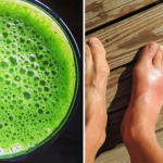 How to Remove Uric Acid Crystallization in Joints for Gout and Joint Pain