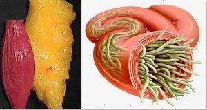 Read more about the article Just Use These 2 Ingredients To Empty All Deposits of Fat and Parasites Of Your Body Without Effort