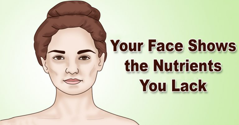You are currently viewing 5 Signs of Nutrient Deficiencies That Are Written All Over Your Face