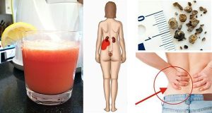 Read more about the article How To Make The Most Powerful Juice That Naturally Removes Kidney Stones And Gallstones!