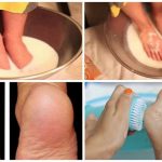Don’t Waste Your Money on Pedicure Anymore: Just Two Ingredients from Your Kitchen Can Make Your Feet Look Amazing!