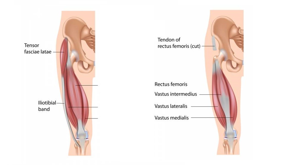 You are currently viewing The Best 6 Ways to Relieve Sore Muscles Without Any Medication