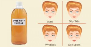 Read more about the article 50 Amazing Ways To Use Apple Cider Vinegar For Health And Home