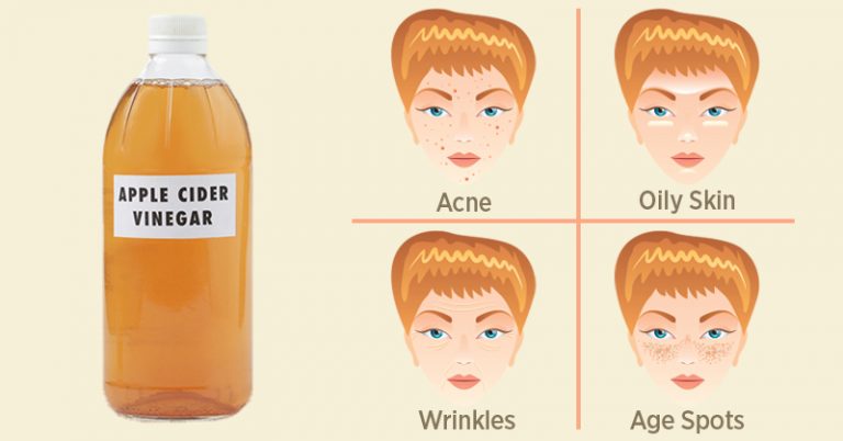 You are currently viewing 50 Amazing Ways To Use Apple Cider Vinegar For Health And Home