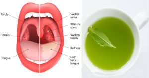 Read more about the article The Tea That Cures Strep Throat, Flu And Sinus Infections