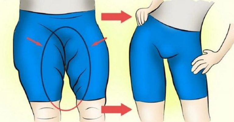 You are currently viewing The Best Exercise for Inner Thighs: Do It Once a Day and Your Legs Will Be Irresistible!