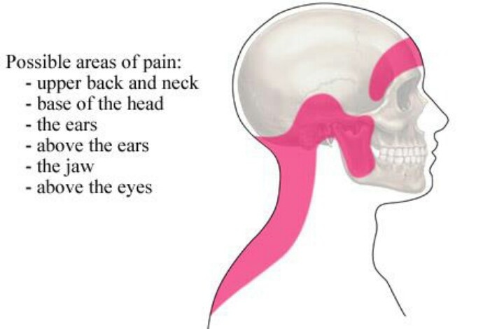 You are currently viewing This Vitamin Deficiency Causes Migraines and Headaches (and here is how to fix it)