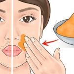 Get Rid of Facial Hair With These Natural Remedies