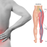 8 Sciatica Stretches That Prevent and Relieve Hip and Lower Back Pain
